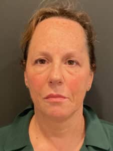 After Image: T-Shape 2