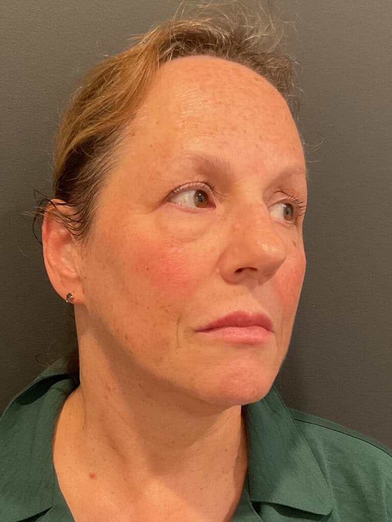 After Image: T-Shape 2 - right-front-oblique