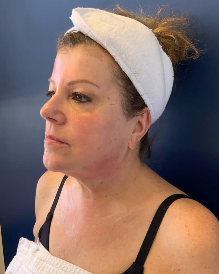 After Image: T-Shape 2 - left-front-oblique